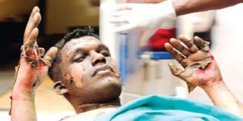 Youth in love dies of burns