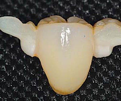 Get that dazzling smile