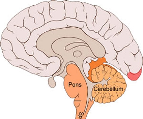 Why light worsens migraine?