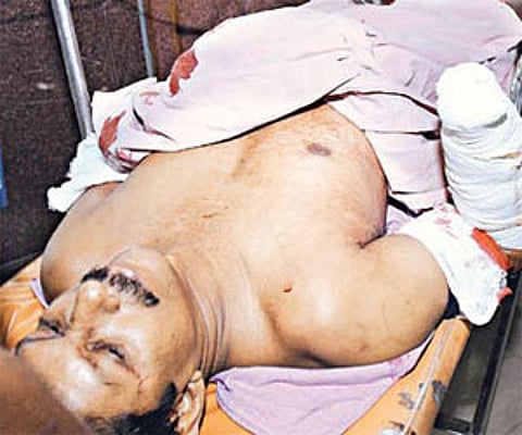 T J Joseph being brought to a private hospital in Kochi on Sunday.