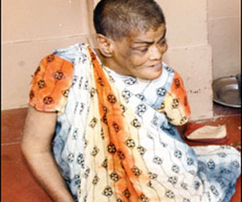 Mysore hospital staff nurse woman for 50 years