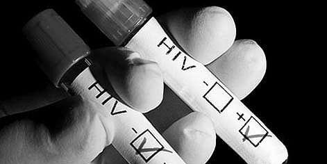 HIV-infected Face Stigma in Hospitals in the State