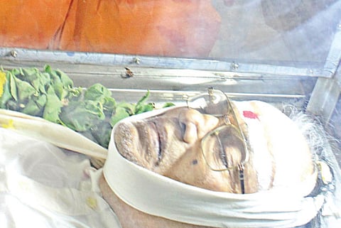 TMS feats later became benchmarks