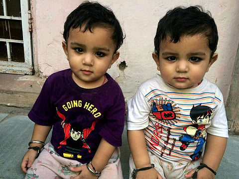 The Delhi twins who turned one this Diwali,since they were conceived as monoamniotic twins sharing the same amniotic sac within the uterus. (Photo | PTI)
