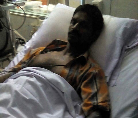 A person Injured in a fire accident at SHAR in Nellore on Wednesday. ( EPS)