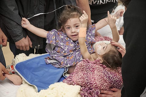 The conjoined twins Eva and Erika Sandoval say goodbye to their family before being taken to the operating room for separation | AP