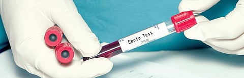 De‘wise’ inventions