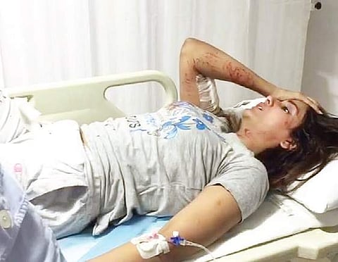 Parul Yadav undergoing treatment at Kokilaben Hospital in Mumbai on Tuesday