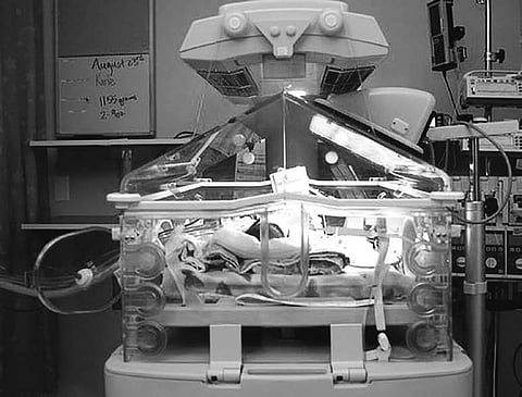 NeoLight, the device that uses the resonant power of light to cure jaundice in infants at work