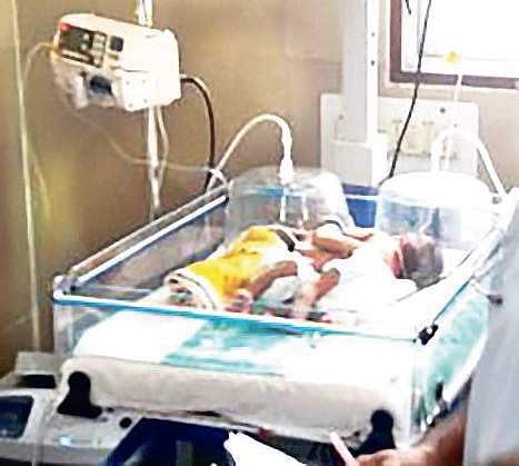 Tough task for docs as twins share heart, liver