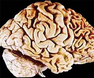 Image of brain: Courtesy to Wikimedia Commons