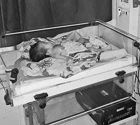 The baby girl under treatment at the District Headquarters Hospital | Express