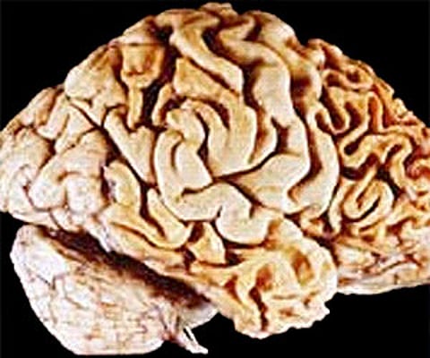 Image of brain: Courtesy to Wikimedia Commons