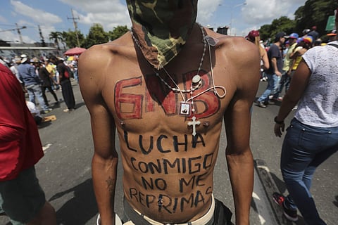 A protester wears a message on his torso directed at government security forces that reads in Spanish: 'Fight alongside me, do not repress me' during a demonstration by opponents of President Nicolas Maduro who gathered to block a major highway in Caracas