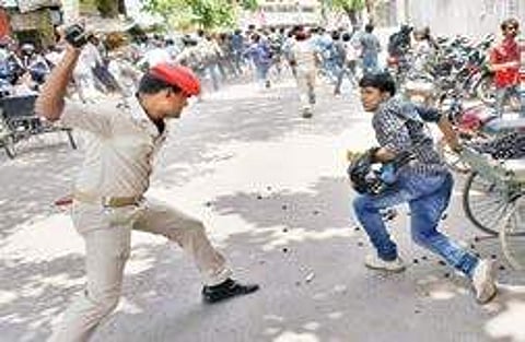 Representative image.