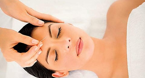 Punch sinus bradycardia away with acupuncture