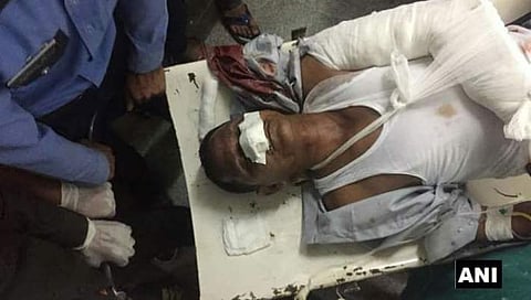 Image of one of the Amarnath Yatra victim at the hospital. | ANI