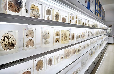 Country’s sole brain museum to get a digital makeover Soon