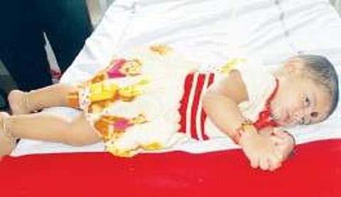 One year old Navya undergoing treatment in Guntur Government Hospital | Express