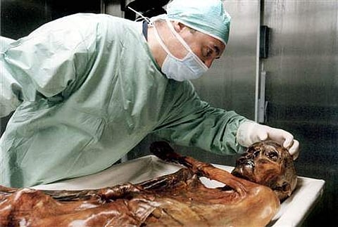 A researcher examines the 5,200-year-old body of a Bronze Age hunter known as Ötzi in Bolzano, Italy. (AP file photo)