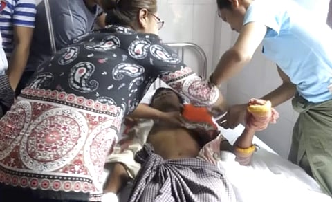 A victim being treated at a hospital in Buthidaung township (AP)