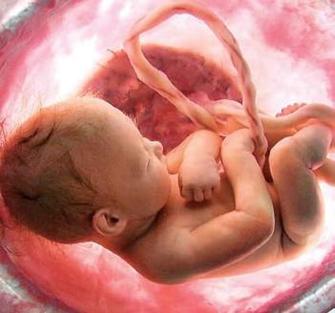 Female foeticide: British journal hints India has a long way to go