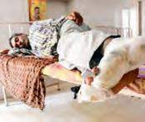 Number of leprosy cases highly underestimated, fear activists