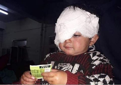 Baby Hiba with pellet wounds in her eye. (Photo: Twitter / @MirwaizKashmir)