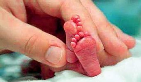 Representative image