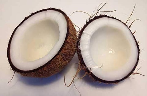 Image used for representational purpose.