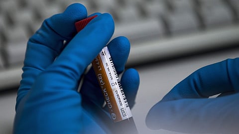 This was the first dope-positive case from the National Inter-State Championships, which was the final qualifying event for the Paris Olympics