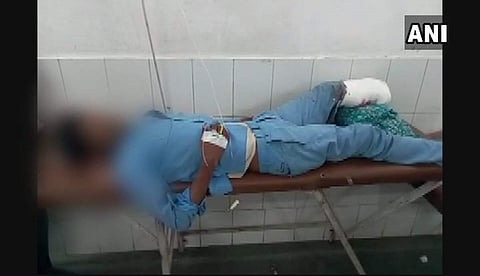 The injured school bus conductor whose severed leg was used as a pillow (ANI UP Twitter)