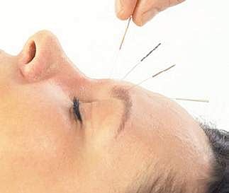 Acupuncture to cure non-specific eye diseases