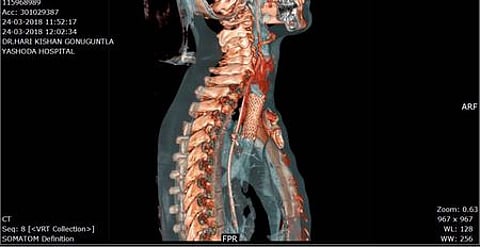 x-ray072158