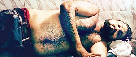 Kashif Jameel, Dr Kafeel Khan’s brother, at the hospital | Express Photo