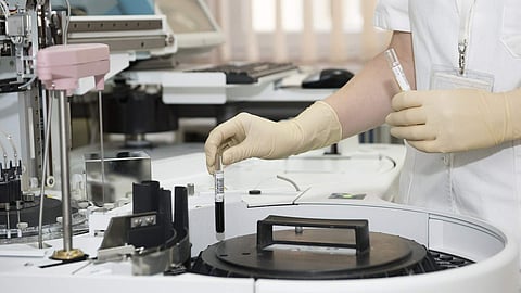 Image for representational purpose only.