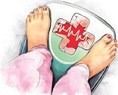 Obesity: Newer ways of treatment and solutions