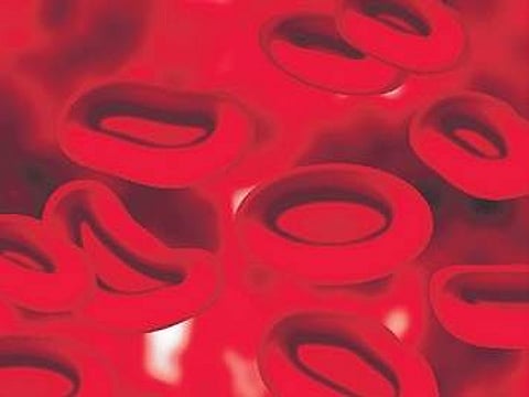 What causes blood cancer?