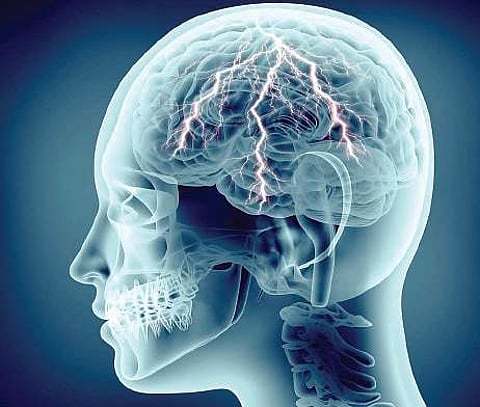 Taking on the epilepsy challenges