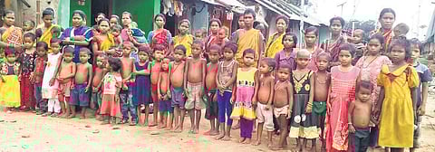 Malnourished children along with their mothers in Badaansupa village under Patrapur block I Express