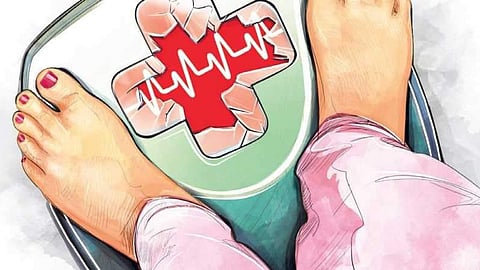 For representational purposes