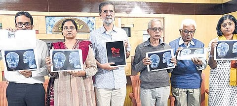 Filmmaker Sanjay Kak, advocates Aarti Mundkur and Clifton D Rozario, Nagari Babaiah of People’s Democratic Forum and others hold up X-rays of Kashmiris who were shot with pellets, in Bengaluru on Thursday | Nagaraja Gadekal