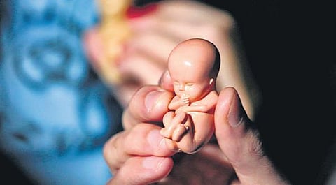 For representational purposes