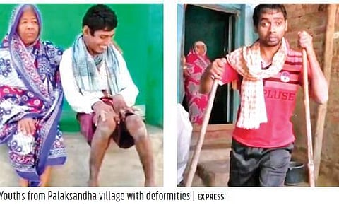 A majority of families have at least one person or a child suffering from deformity.