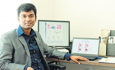 AI could monitor breast cancer