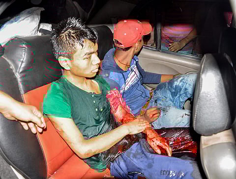 An injured is rushed to hospital for treatment after suspected grenade blast in Assam (Photo | PTI)