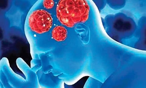 For representational purposes (Express Illustrations)