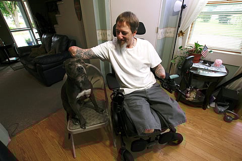 In this Aug. 16, 2019 photo, Greg Manteufel pets his dog Ellie at his home in West Bend, Wis. Manteufel lost parts of his arms and legs, as well as the skin of his nose and part of his upper lip from capnocytophaga, a bacteria commonly found in the saliva