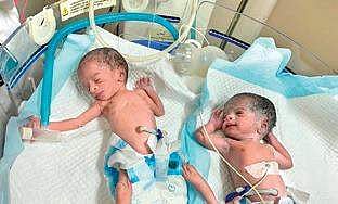 Twins delivered by 74-year old (Photo |EPS)