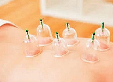 The therapy has been used for health promotion, prevention and therapeutic purposes.